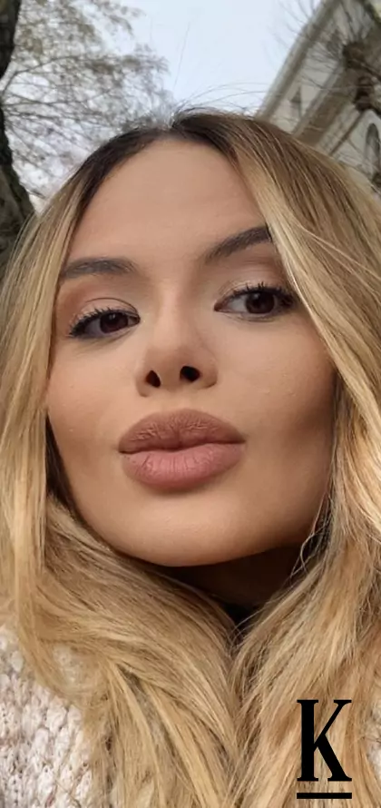 stories-slider-content