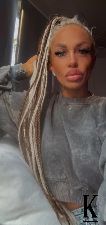 stories-slider-content