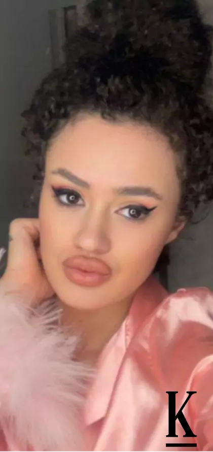 stories-slider-content