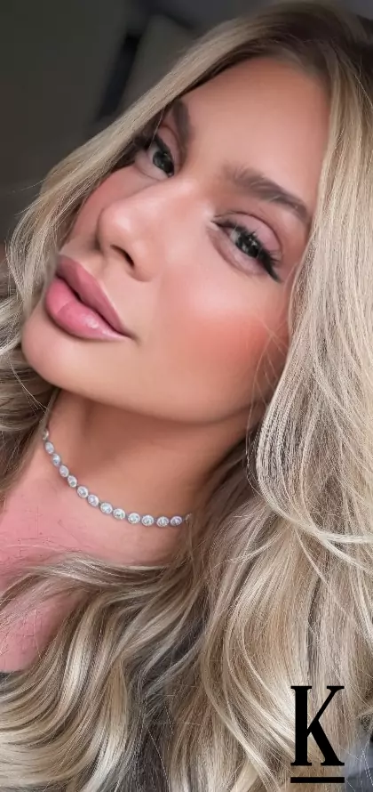 stories-slider-content