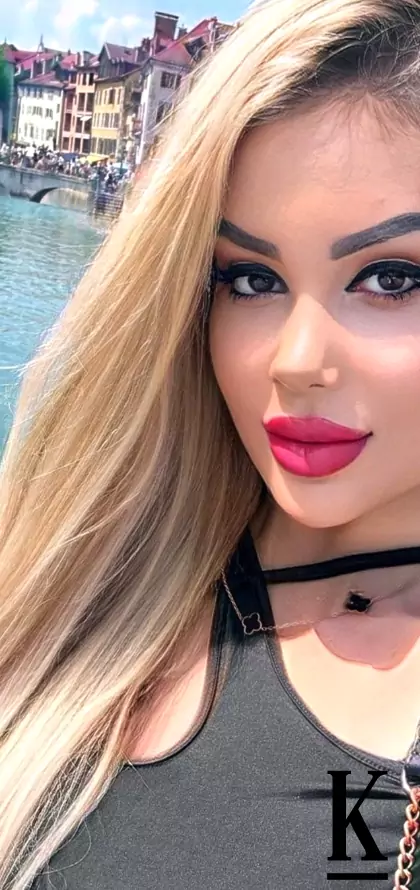 stories-slider-content