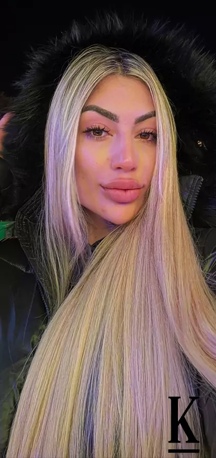 stories-slider-content