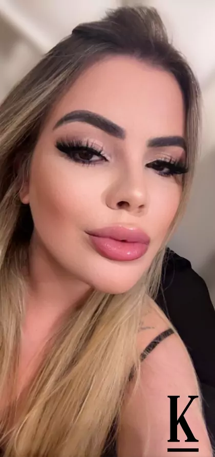 stories-slider-content