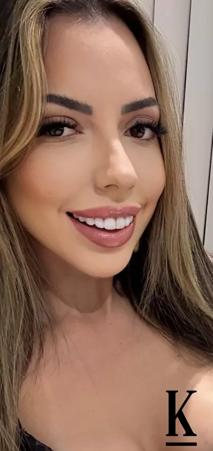 stories-slider-content