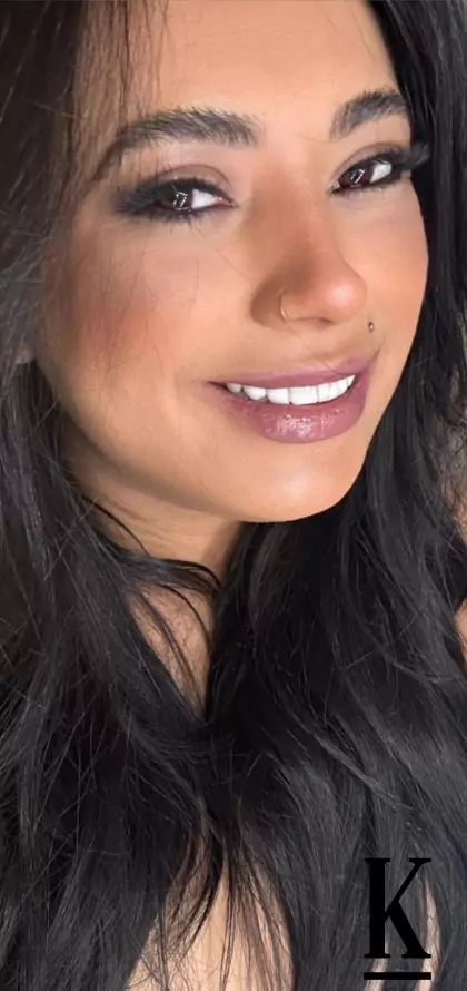 stories-slider-content