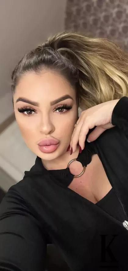 stories-slider-content